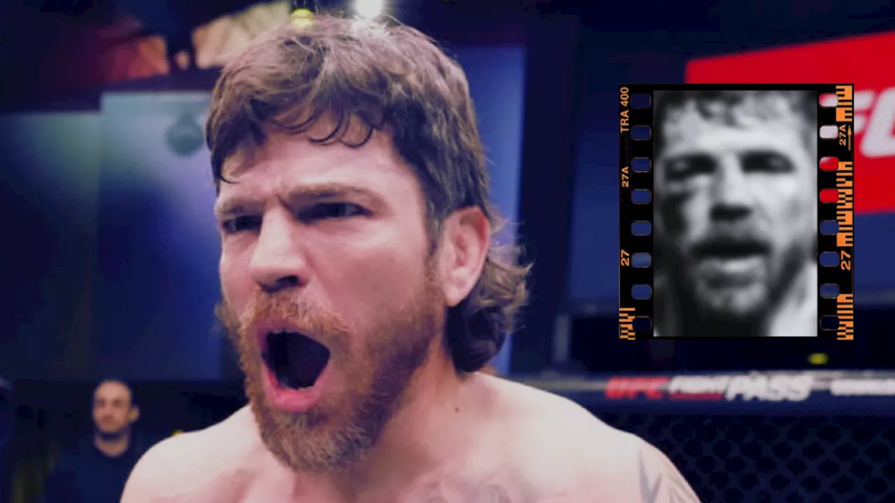 Jim Miller muestra su rostro desfigurado, tras las terribles lesiones después de la UFC 300