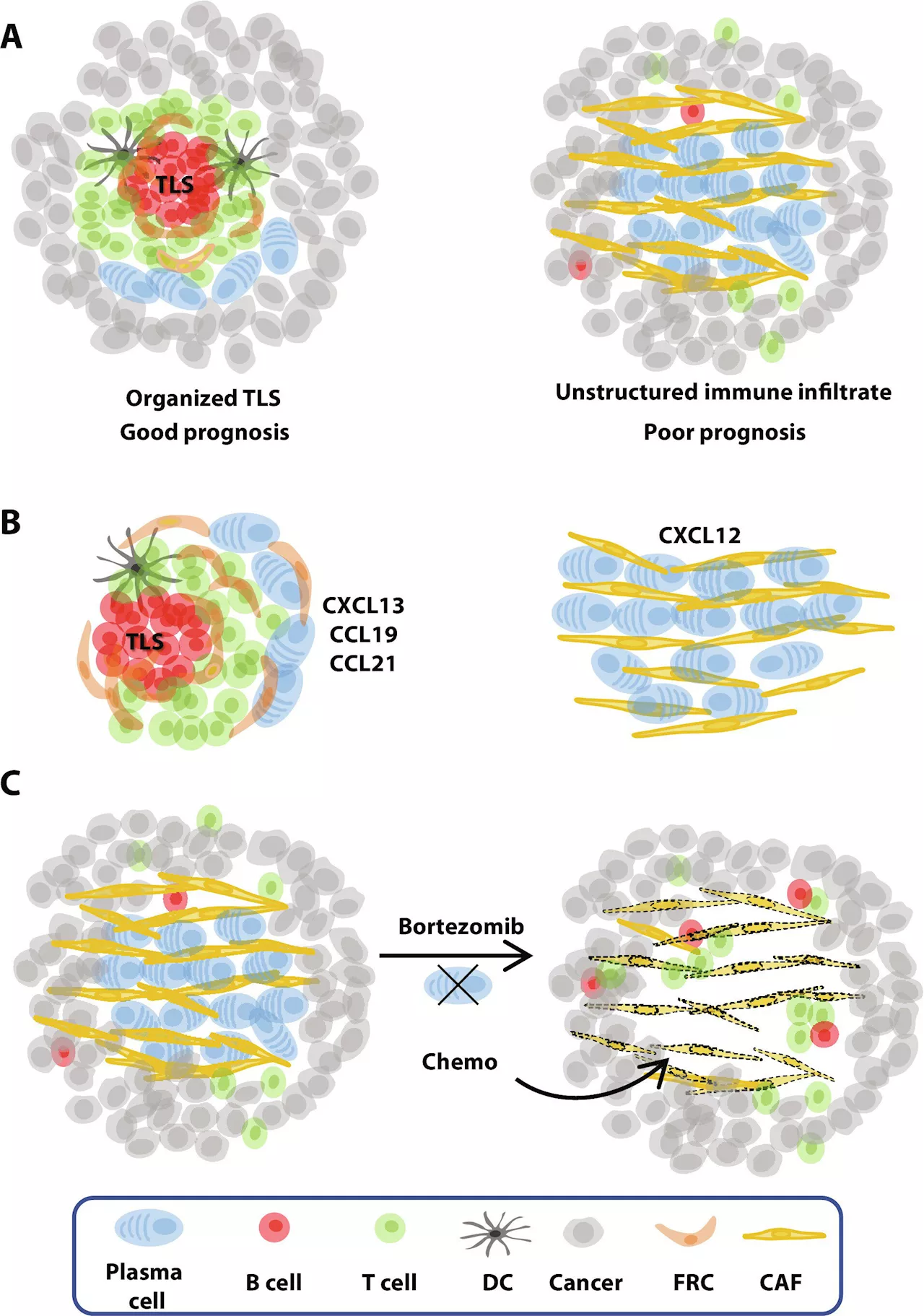 Researchers identify patterns that predict ovarian cancer relapse