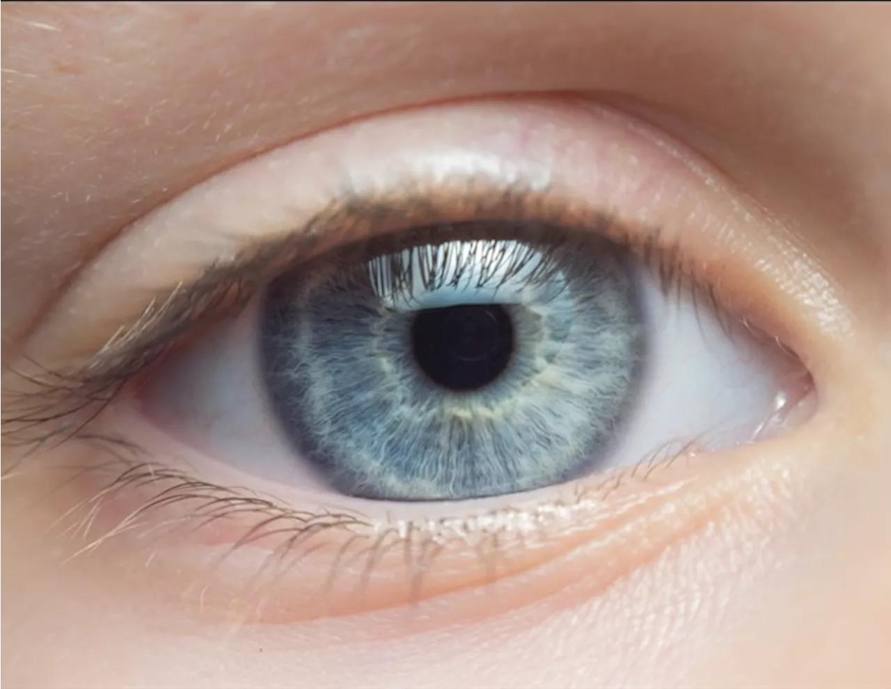 AI model GPT-4 exceeds unspecialized doctors' ability to assess eye problems
