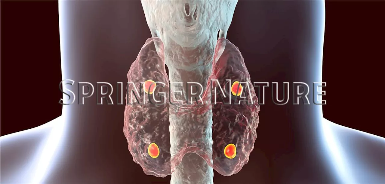 Ascendis Pharma : Chronischer Hypoparathyreoidismus: Parathormon mit längerer Wirkdauer überzeugt auch langfristig