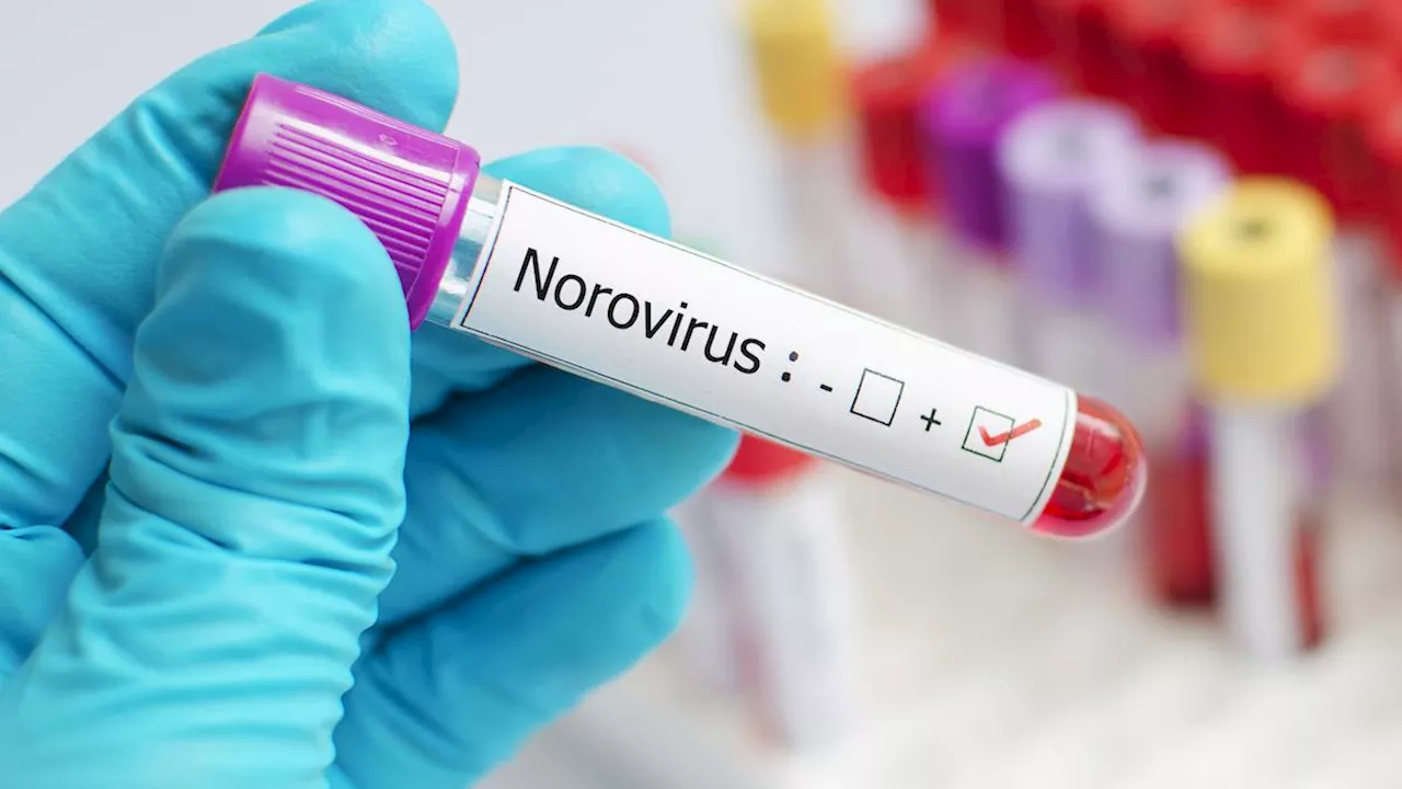 Norovirus: sintomi del microorganismo che ha contaminato l'acqua in alcune aree d'Italia