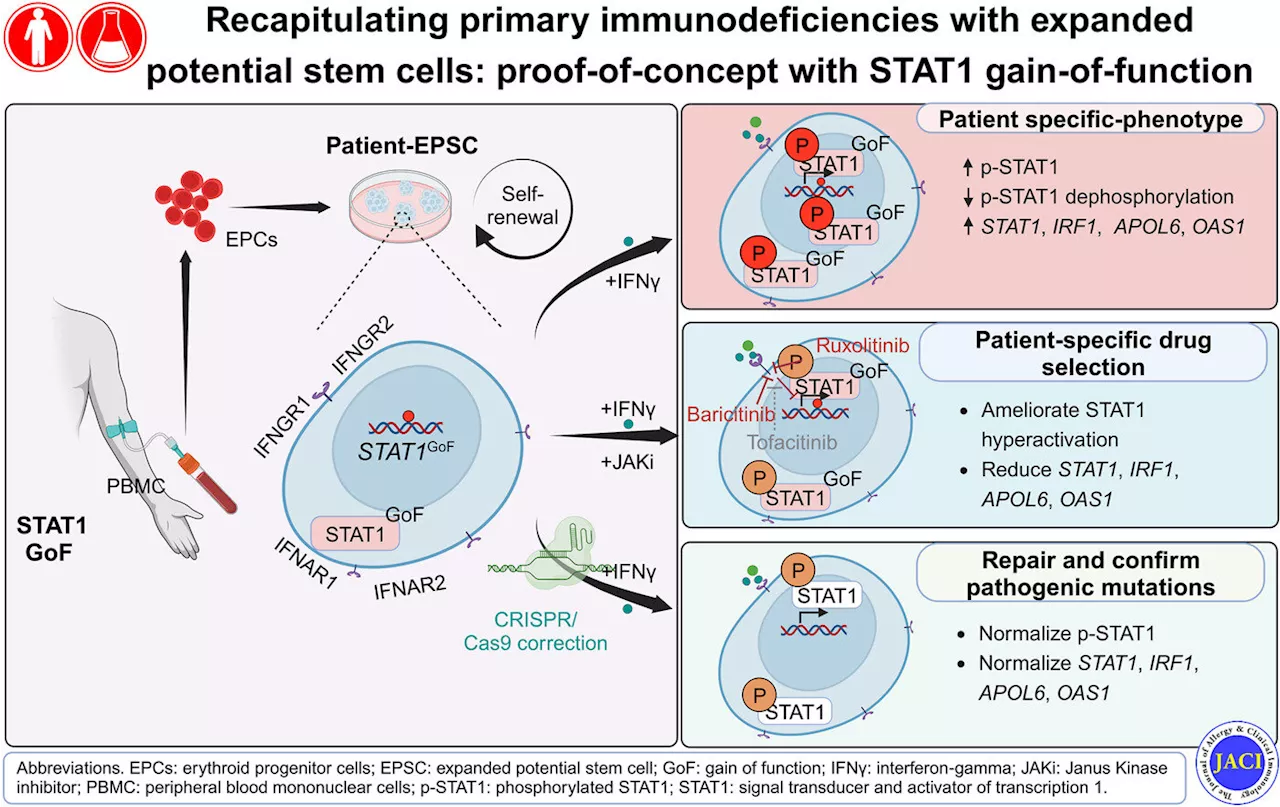 New stem cell model can help personalize stem cell treatment for immunodeficiency patients