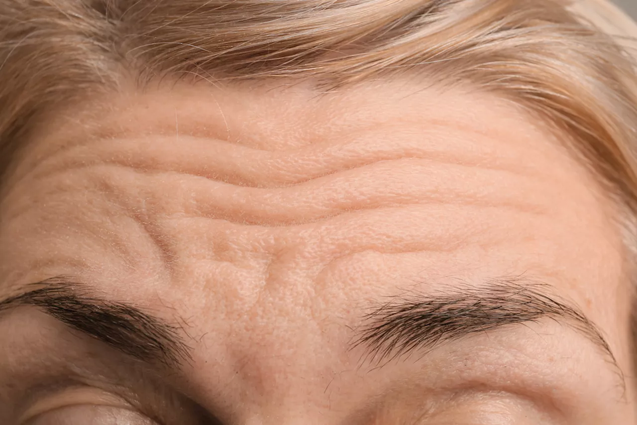 How to Get Rid of Forehead Wrinkles: 18 Dermatologist-Approved Tips