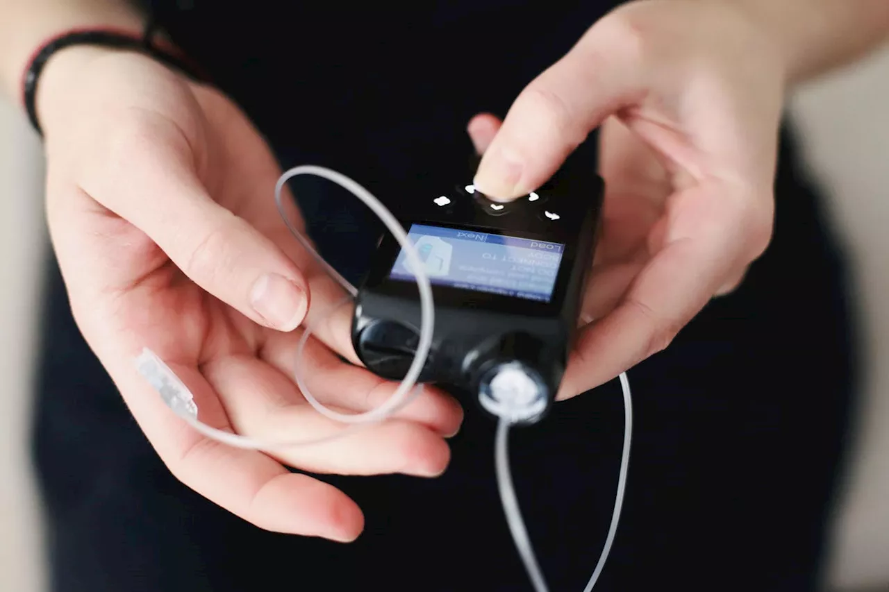 New Technology Mimics Pancreas for Type 1 Diabetes Patients
