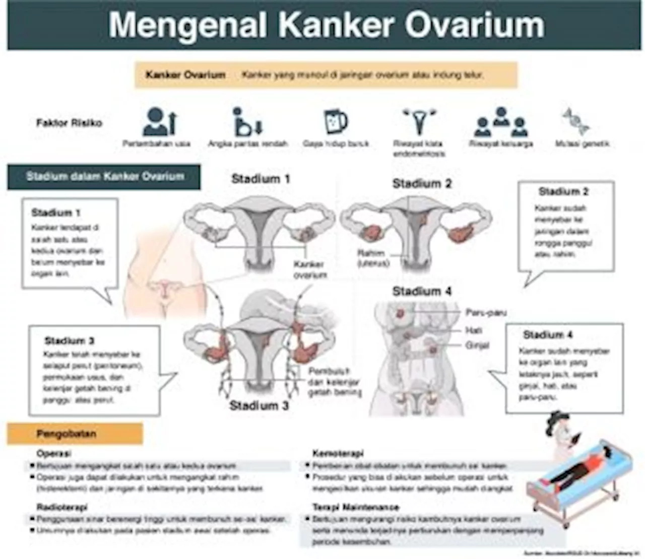 Risiko Kanker Ovarium masih Ada meski Rahim Diangkat