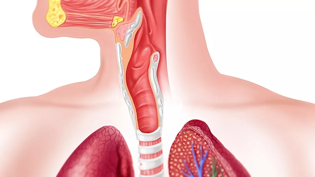 Twice-daily PPI dose leads to higher histologic response rates in EoE patients