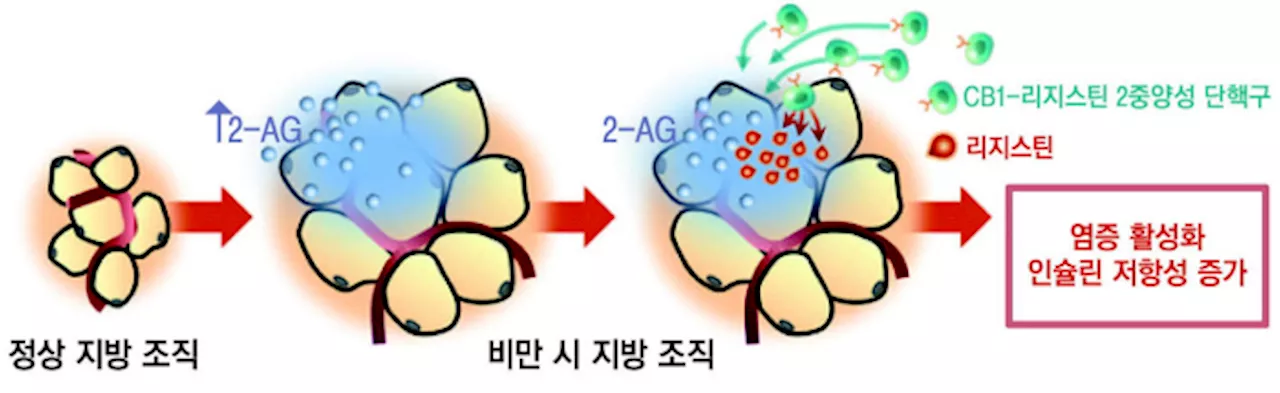 비만 지방조직서 분비되는 염증유발물질이 당뇨병 부른다