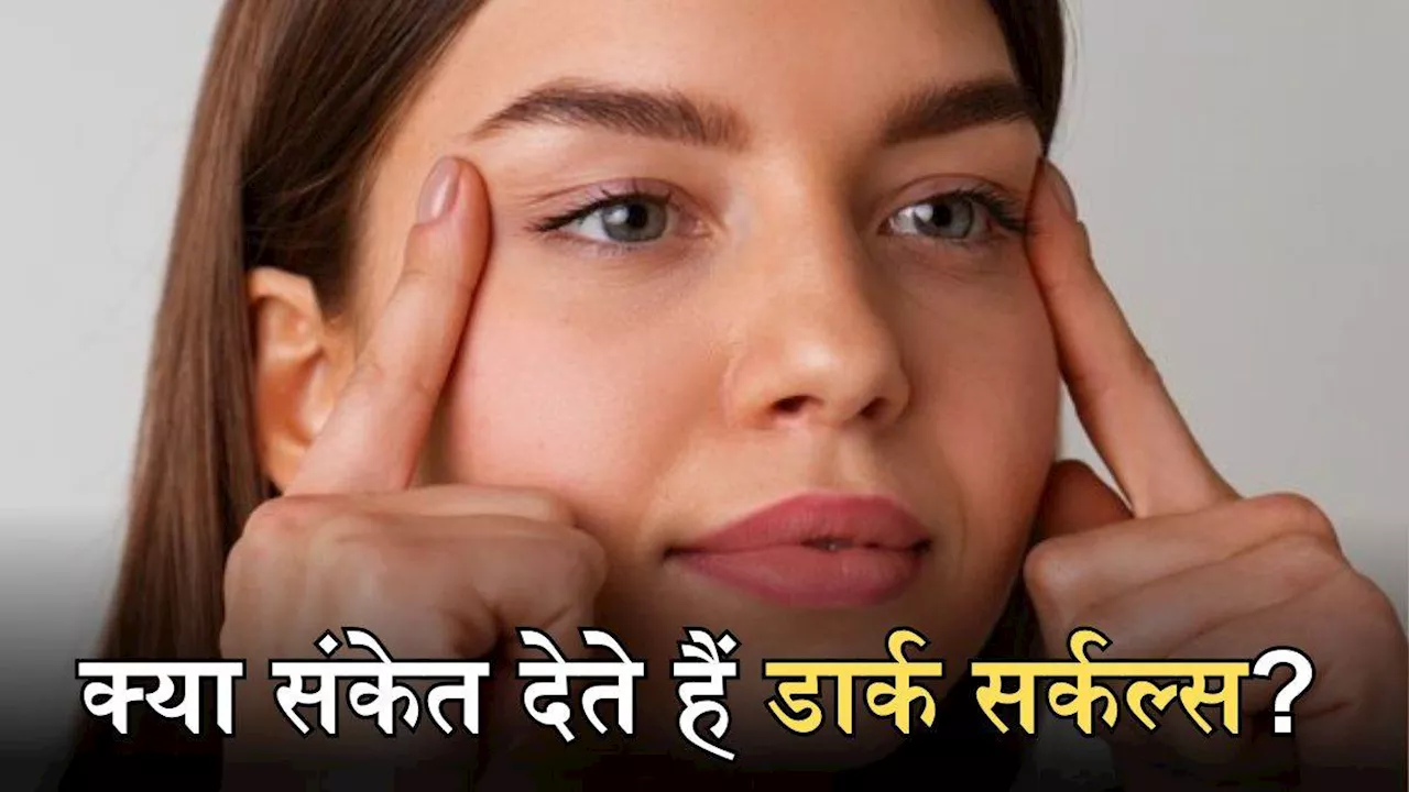 Dark Circles: सिर्फ नींद की कमी ही नहीं, आंखों के नीचे पड़े काले घेरों के पीछे होते हैं ये 8 बड़े कारण!