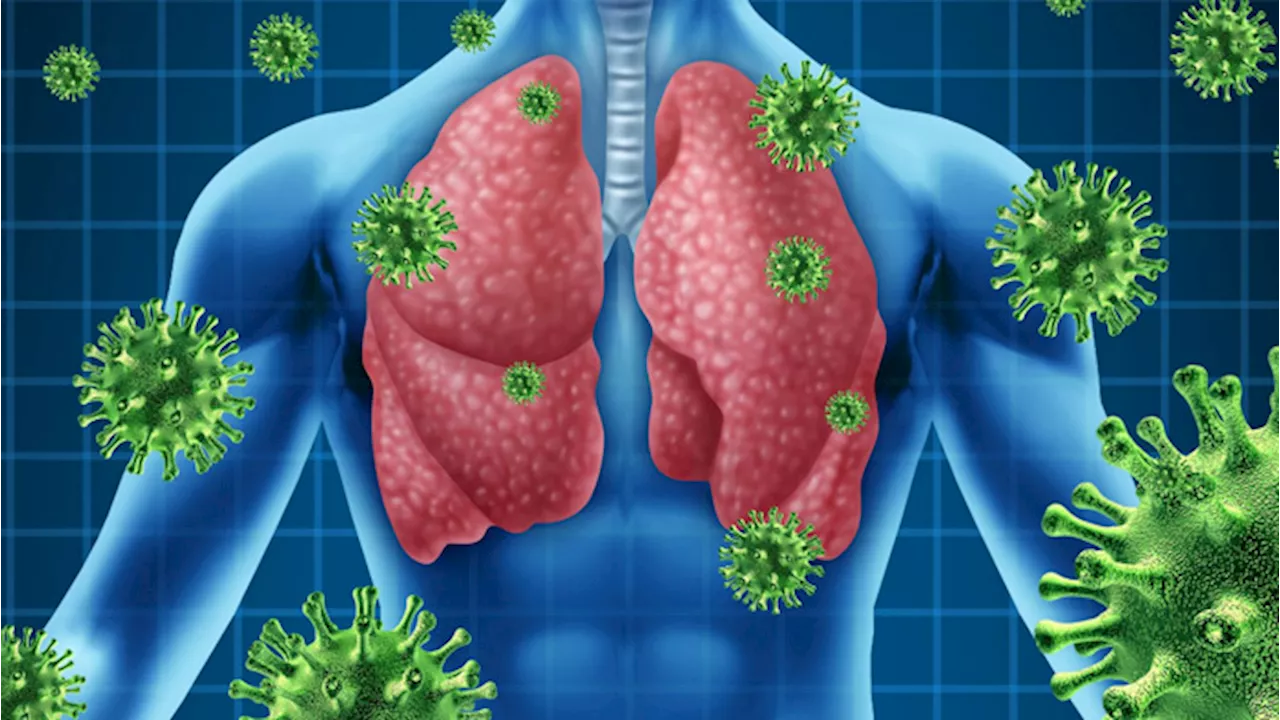 Fibrosi Polmonare Idiopatica, 13 centri italiani forniscono il Pirfenidone