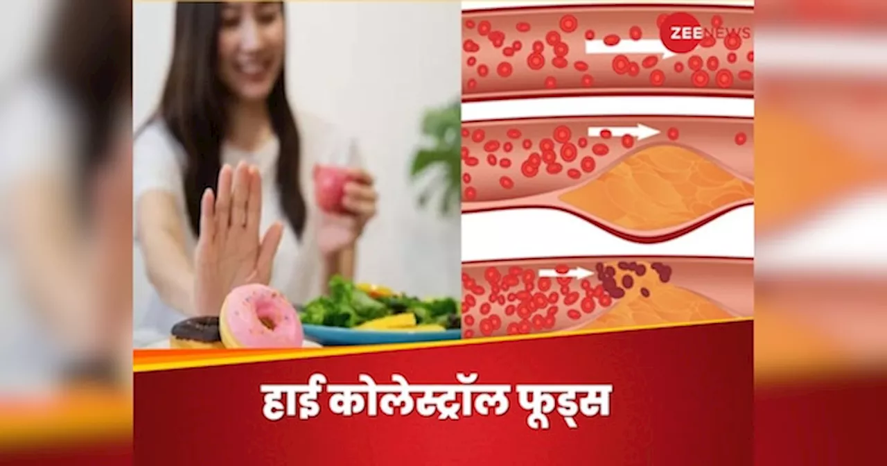 Cholesterol: इन 4 चीजों को डाइट से तुरंत करें आउट, महीनेभर में कम हो जाएगा कोलेस्ट्रॉल