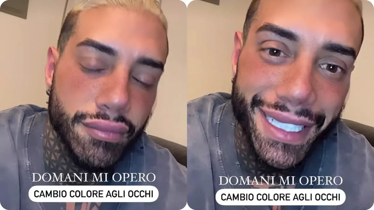 Francesco Chiofalo pronto a cambiare il colore degli occhi, l'intervento oggi: pioggia di critiche