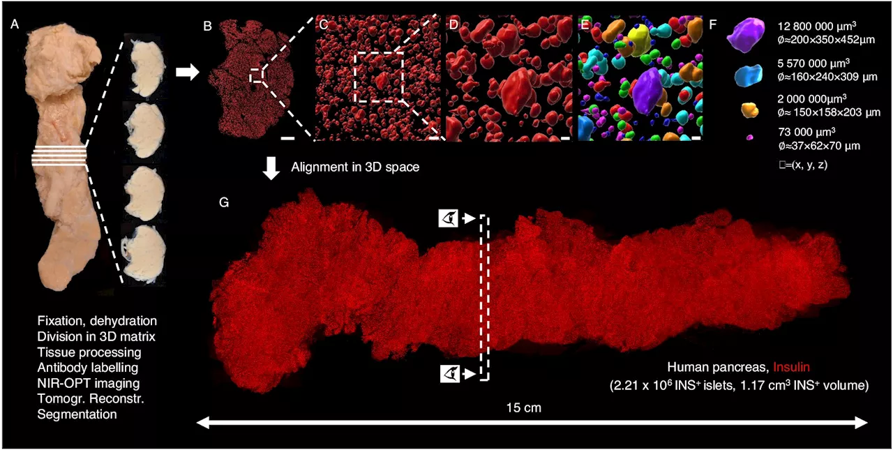 New findings on pancreatic anatomy may affect diabetes research and treatment