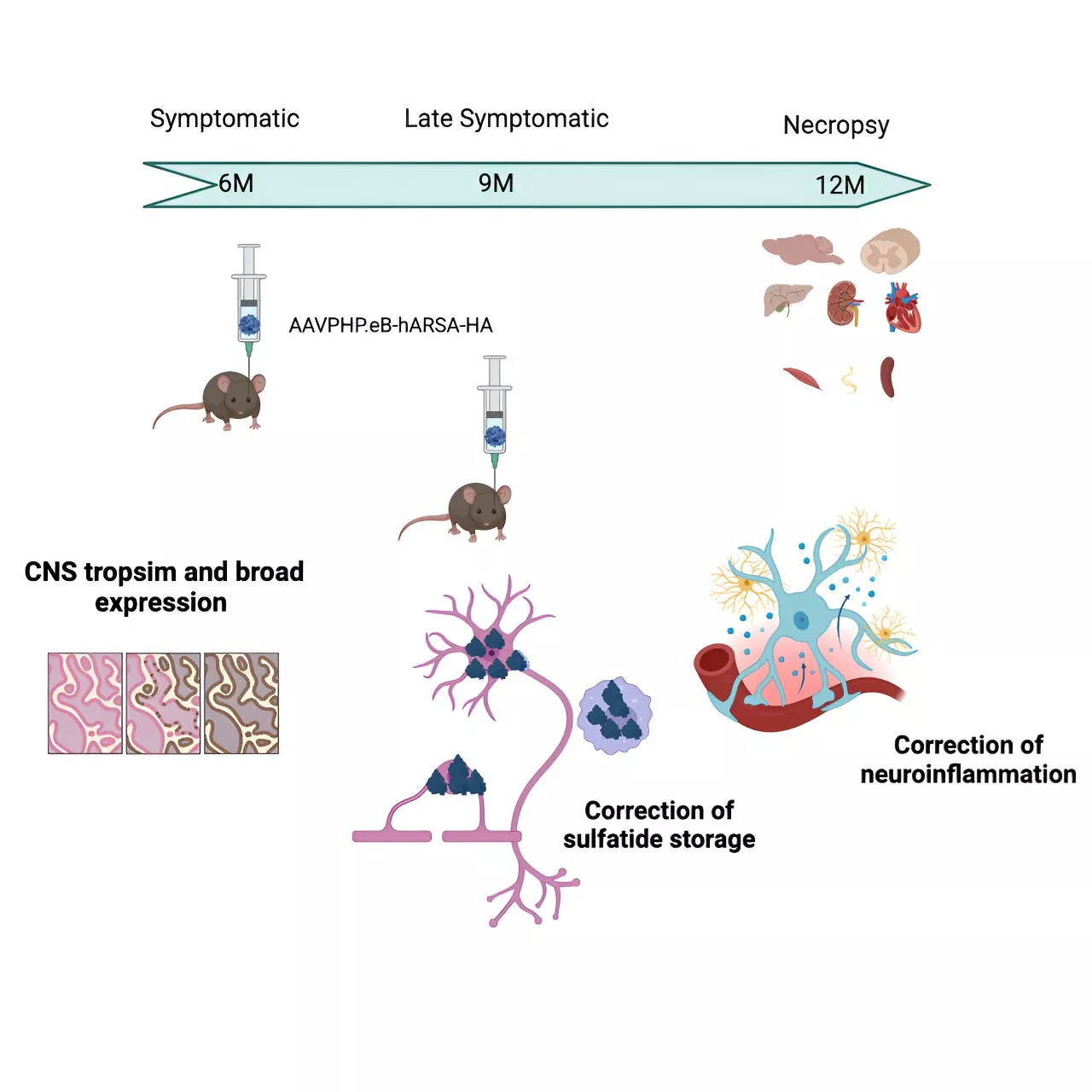 New gene therapy for metachromatic leukodystrophy proves effective in mice