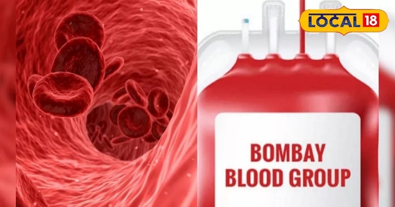 A-B-AB या O नहीं, ये है Bombay Blood, इस ग्रुप के दुनिया में सिर्फ 0.0004 फीसदी लोग, खून की जरूरत पड़े तो क...