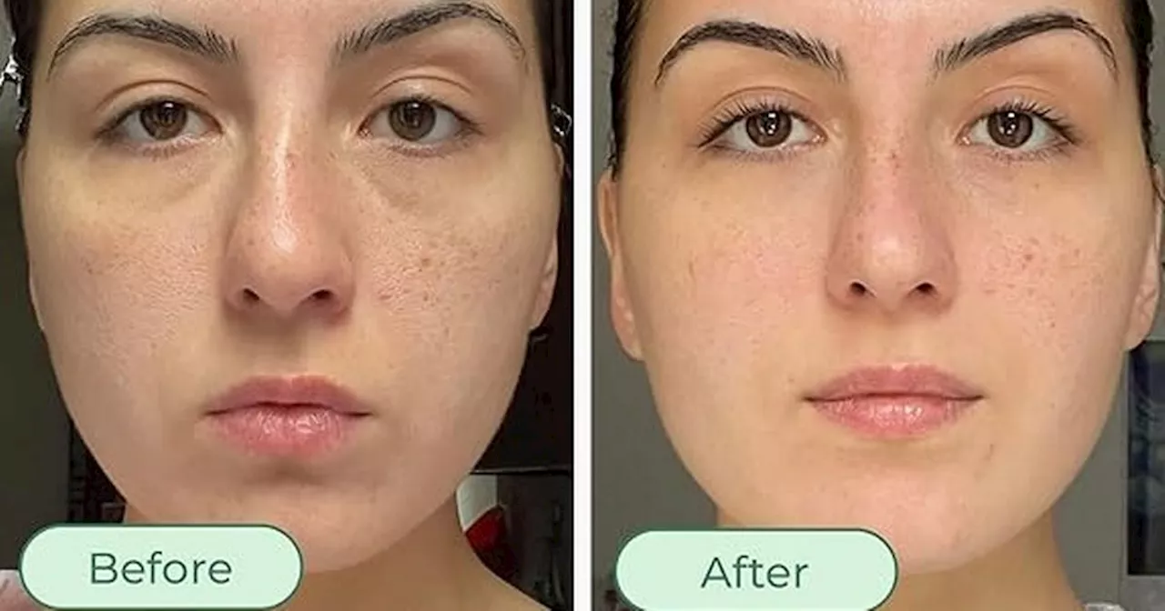 Shoppers swap expensive skin creams for Amazon's £16 anti-aging device