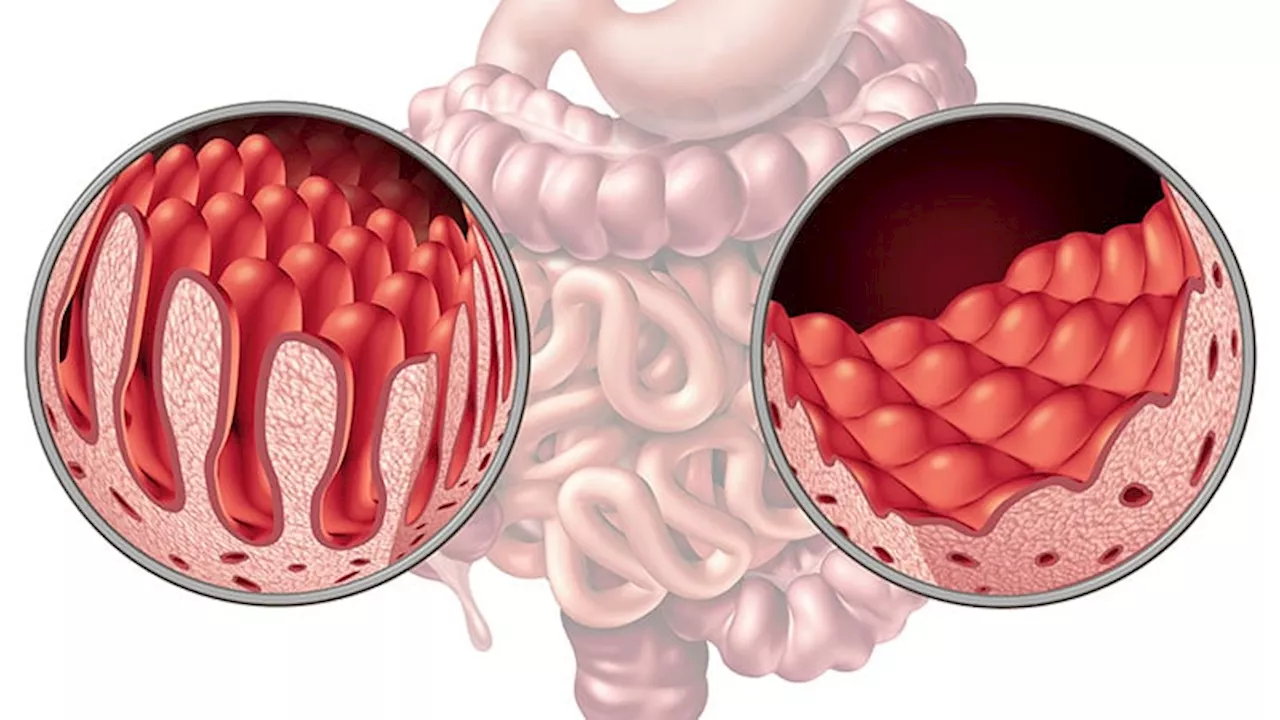 No-Biopsy Diagnosis Appears Effective in Select Adult Patients