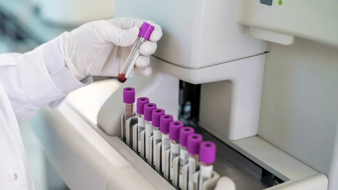AI-powered tool detects cancer in minutes with one drop of blood
