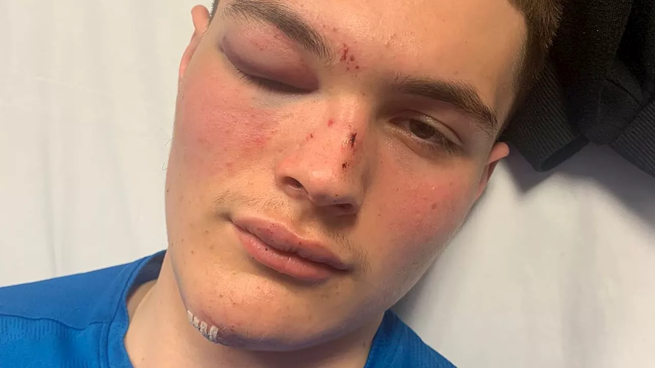 Manchester City fan, 14, suffered 'devastating' 15ft fall onto concrete while celebrating Bernardo...