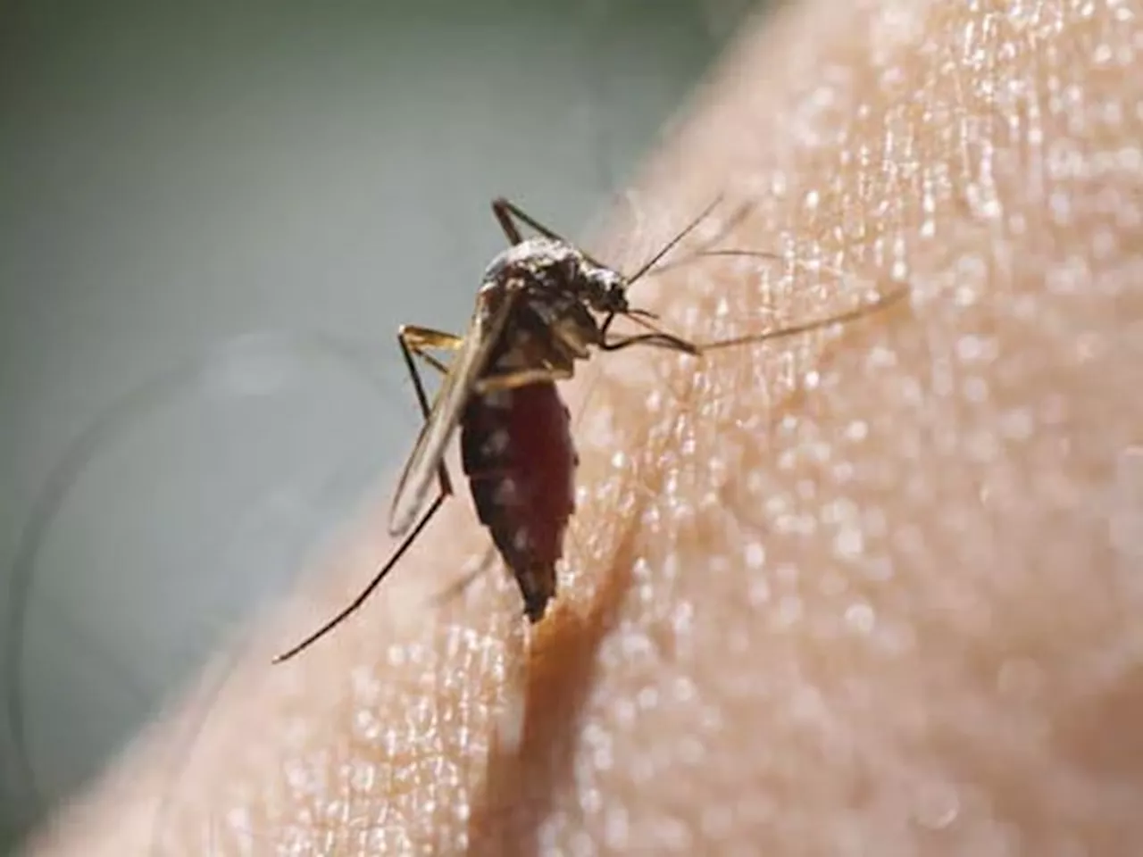 World Malaria Day 2024: मलेरिया क्या है और क्यों होता है, एक्सपर्ट से जानिए इसके कारण, लक्षण, जांच, बचाव और इलाज के बारे में सबकुछ