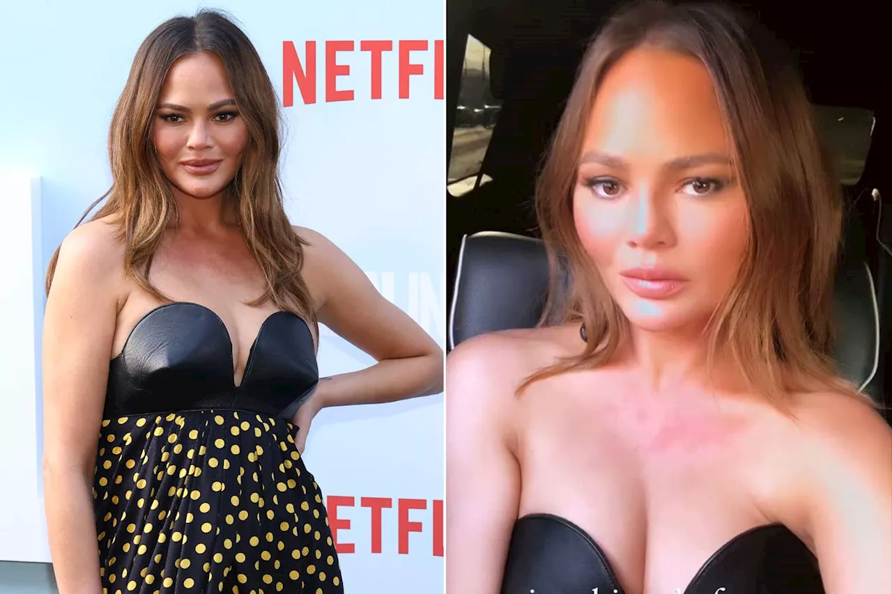 Chrissy Teigen Shares Clip of Her 'Anxiety Hives' Ahead of Red Carpet Appearance: 'Every Event'