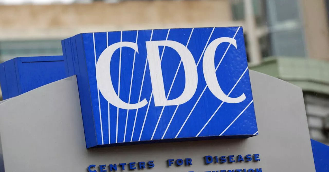 CDC confirms HIV infections linked to 'vampire facials'