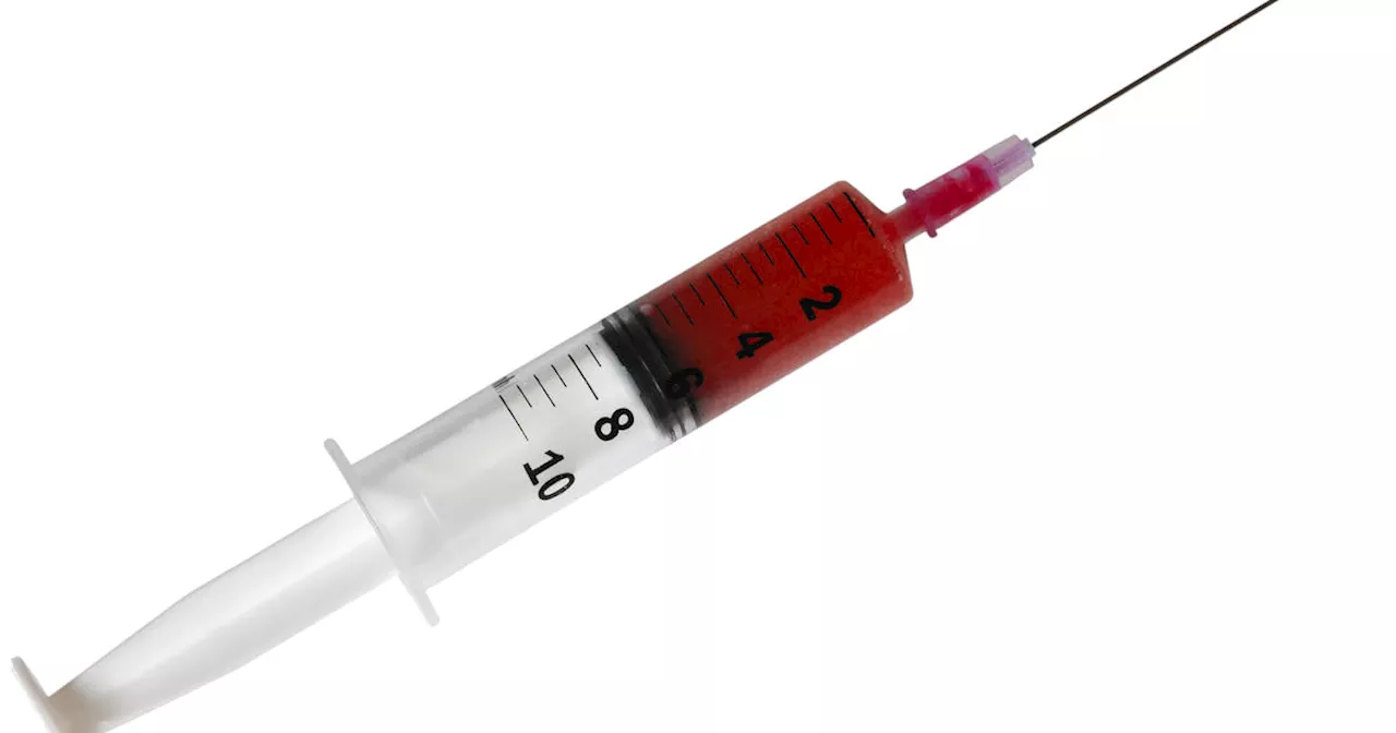 'Vampire facials' at an unlicensed spa infected three people with HIV, CDC finds