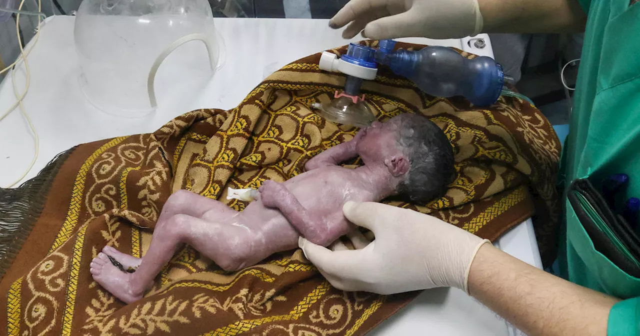 Gaza baby girl saved from dying mother's womb after Israeli airstrike dies just days later