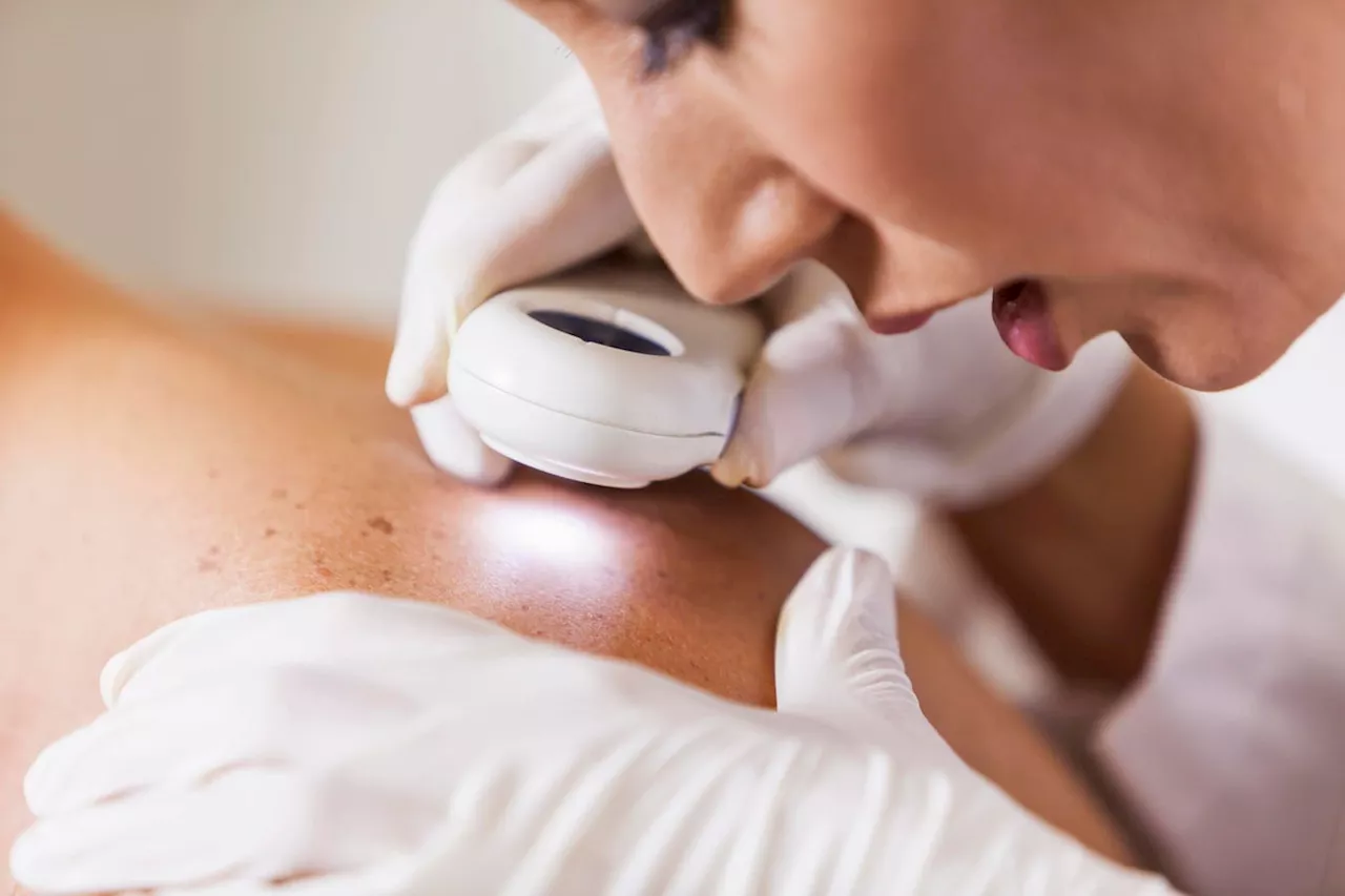 U.K. Tests World-First Personalized Skin Cancer Vaccine