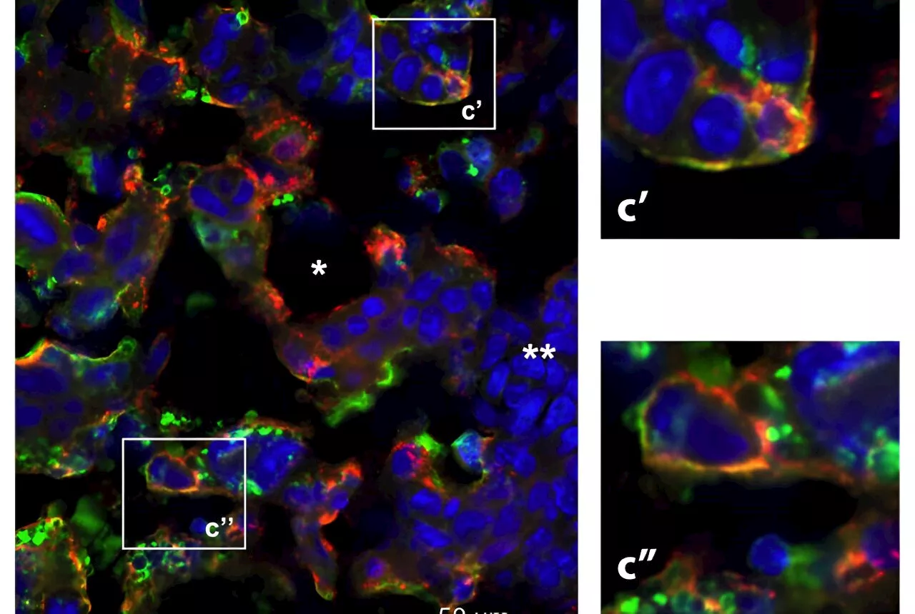 Researchers find pregnancy cytokine levels impact fetal brain development and offspring behavior