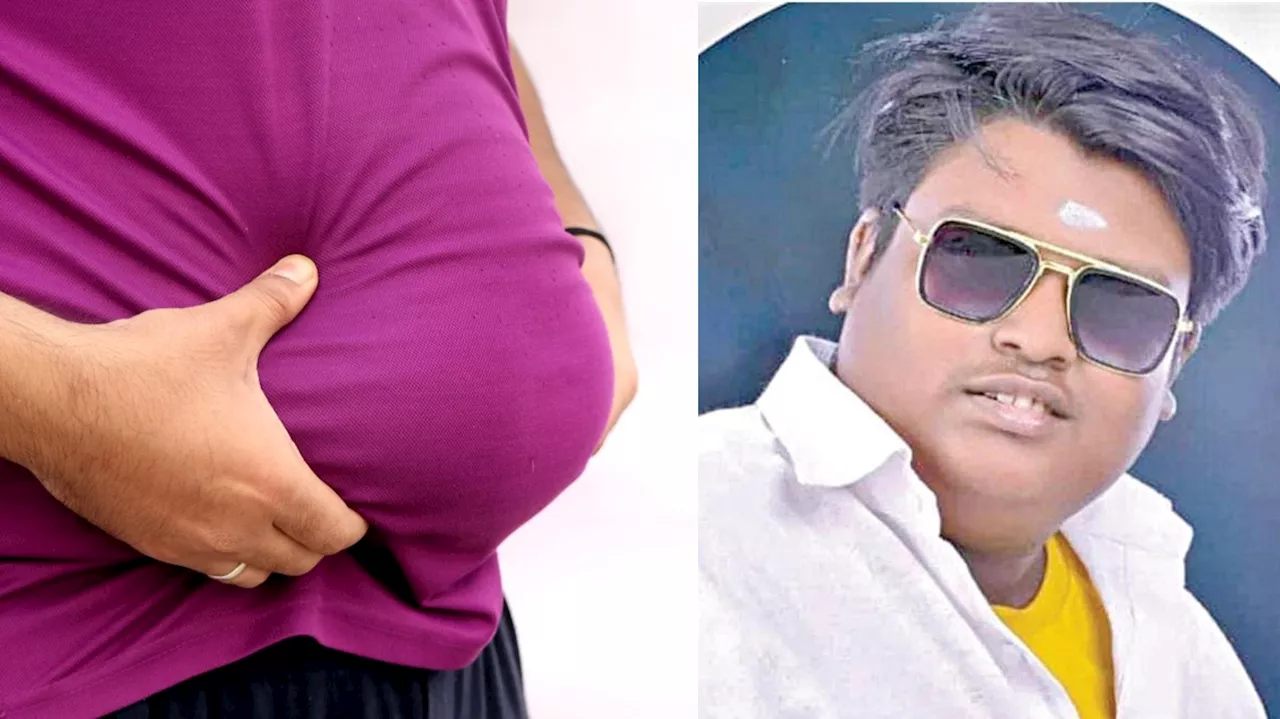 Weight Loss Surgery: ప్రాణం తీసిన అధిక బరువు శస్త్ర చికిత్స.. వయసు 26 ఏళ్లు బరువు 150 కిలోలు