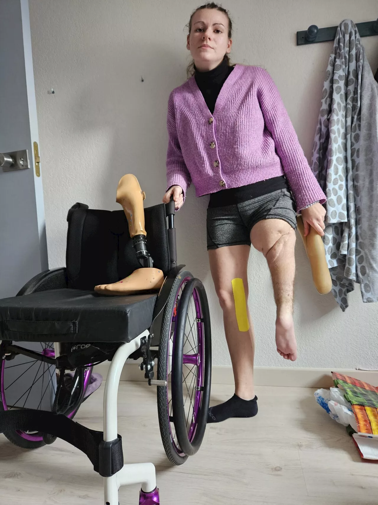 Loire-Atlantique : née avec une jambe plus courte, elle bataille pour faire reconnaître son handicap