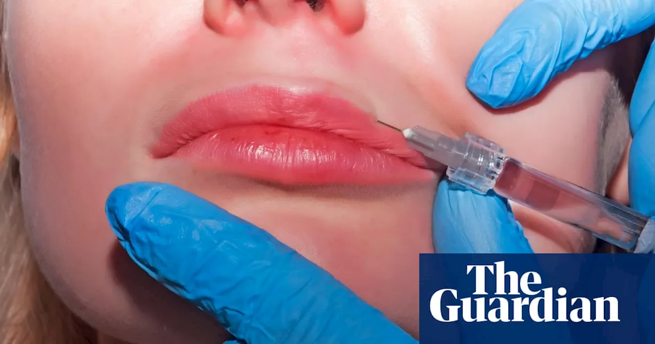 Three women diagnosed with HIV after getting ‘vampire facials’ in New Mexico