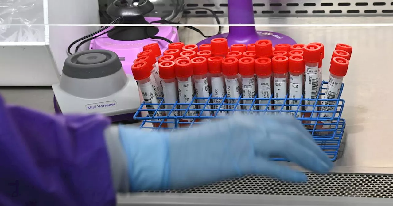 FDA moves to regulate some tests it says may be unreliable