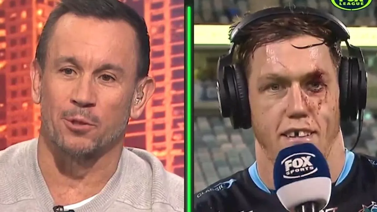 ’Think I might need more stitches’: Battered Sharks star’s instantly-iconic interview with Matty Johns