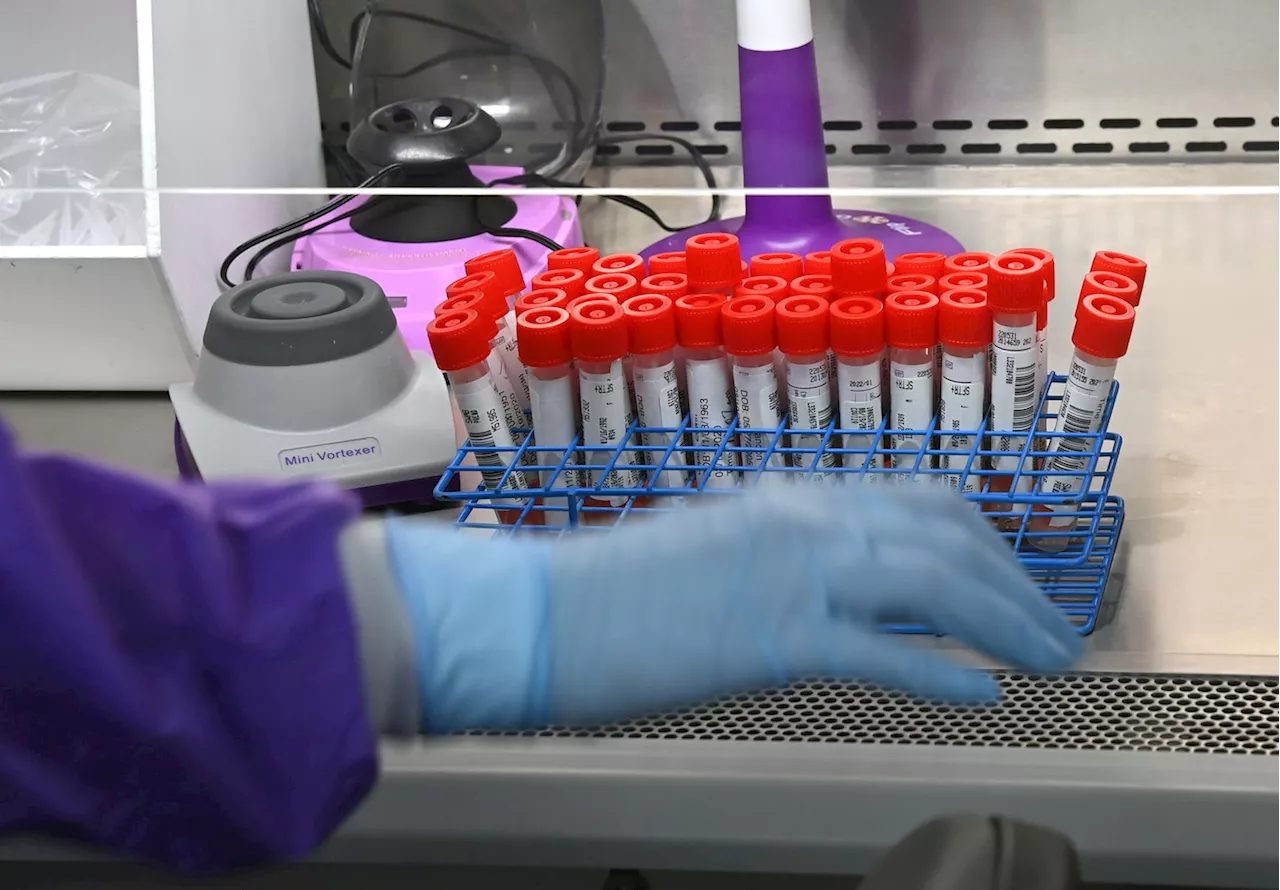FDA moves to regulate some tests it says may be unreliable