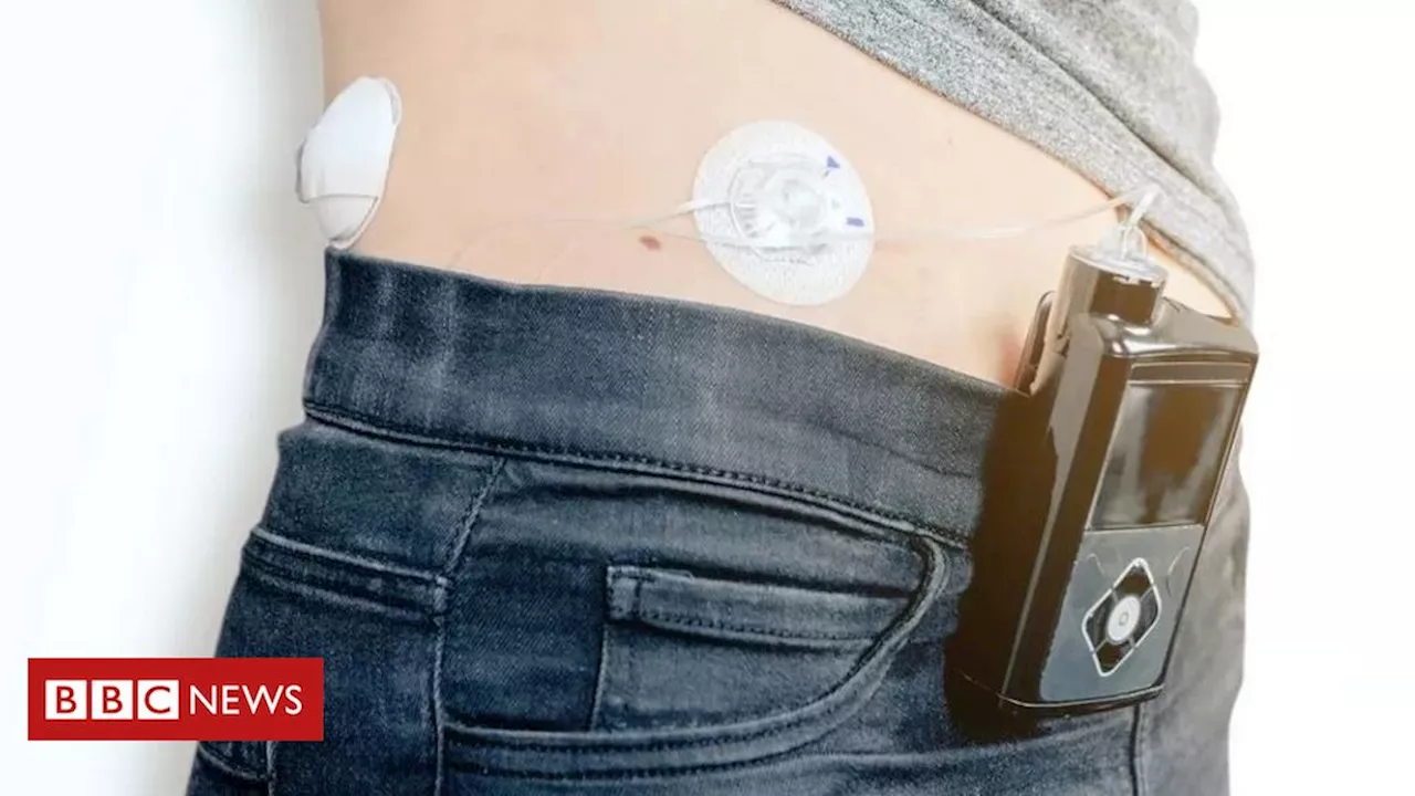 Diabetes: Reino Unido se torna primeiro a oferecer 'pâncreas artificial' na rede pública