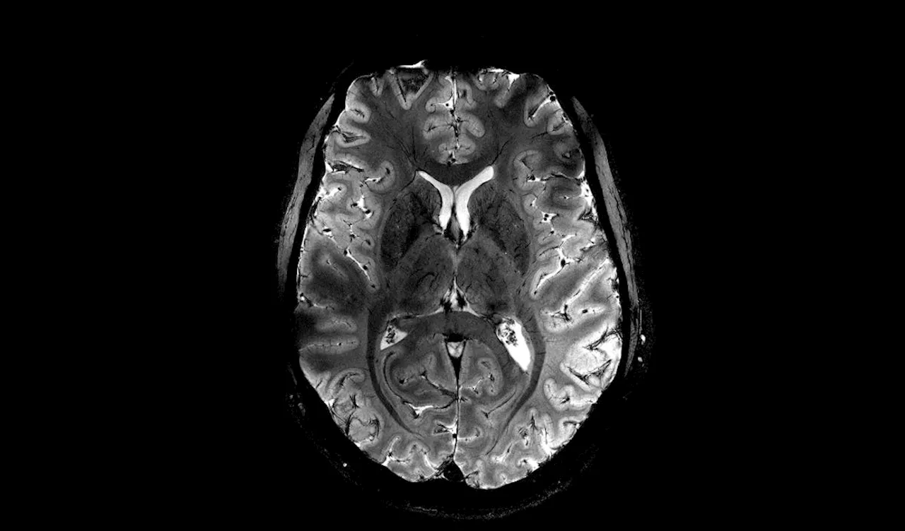 Découvrez les images du cerveau les plus précises du monde