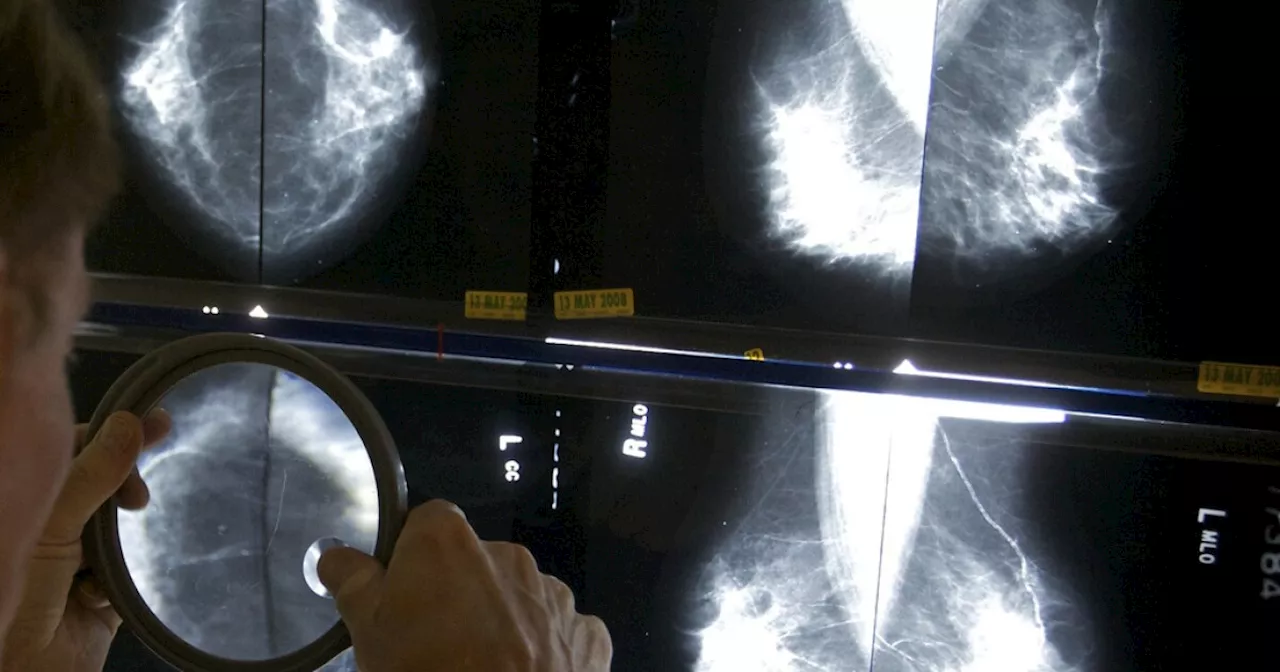 Women should start getting regular mammograms at age 40, US panel officially recommends