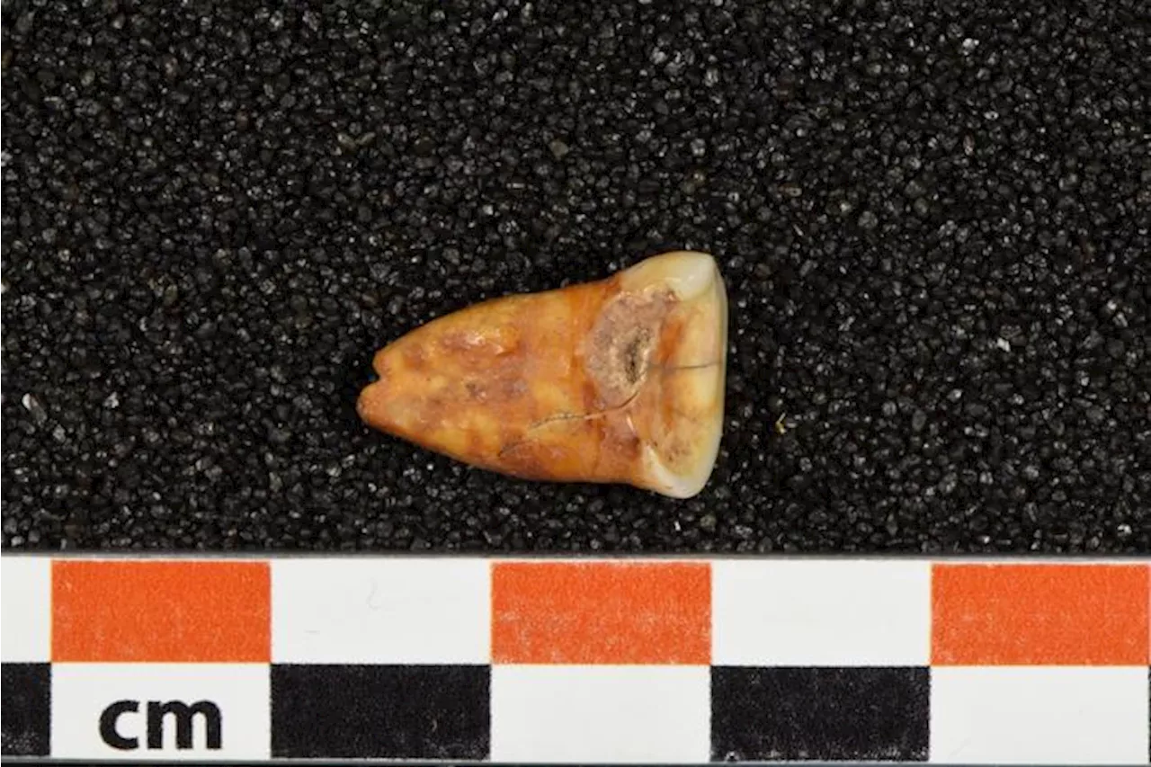 Ancient Teeth and Bones Show Stone Age People Consumed a Paleo Diet