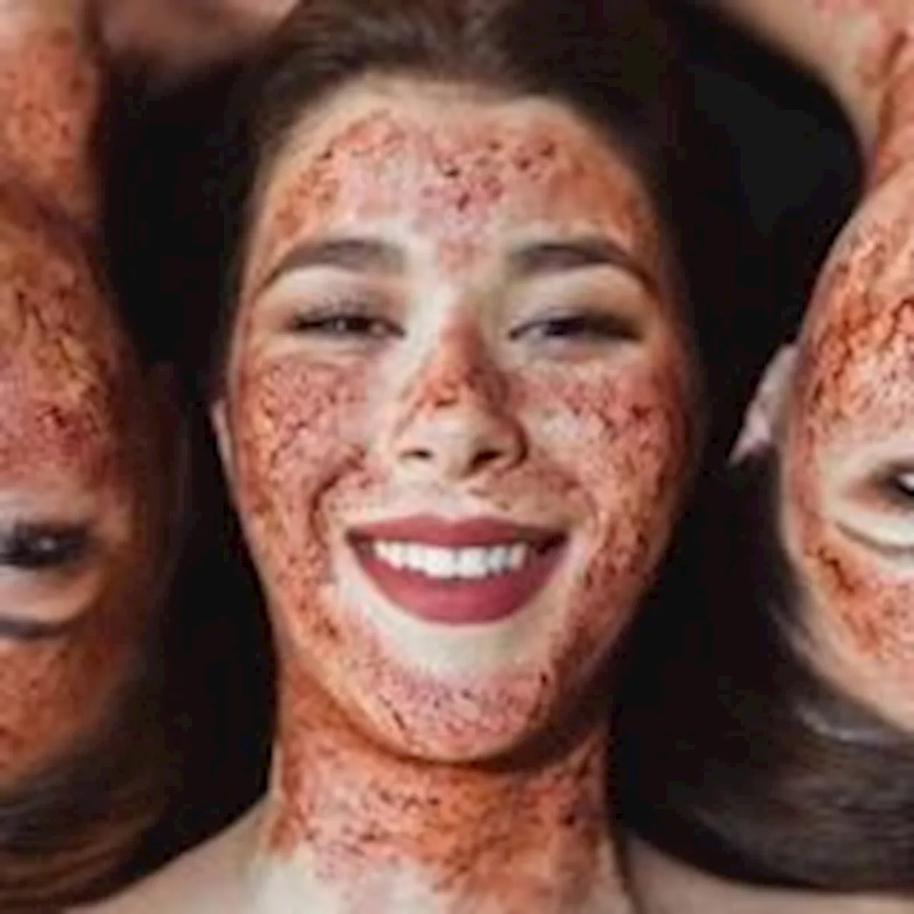 Three Women Infected With HIV Through ‘Vampire Facials’