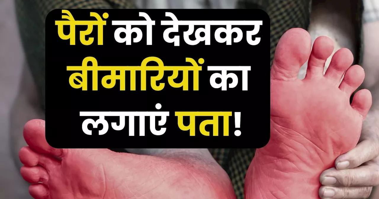 खतरनाक बीमारी की चपेट में तो नहीं हैं आप? पैरों में दिखे 7 लक्षण तो तुरंत भागें अस्‍पताल, लापरवाही पड़ सकती...