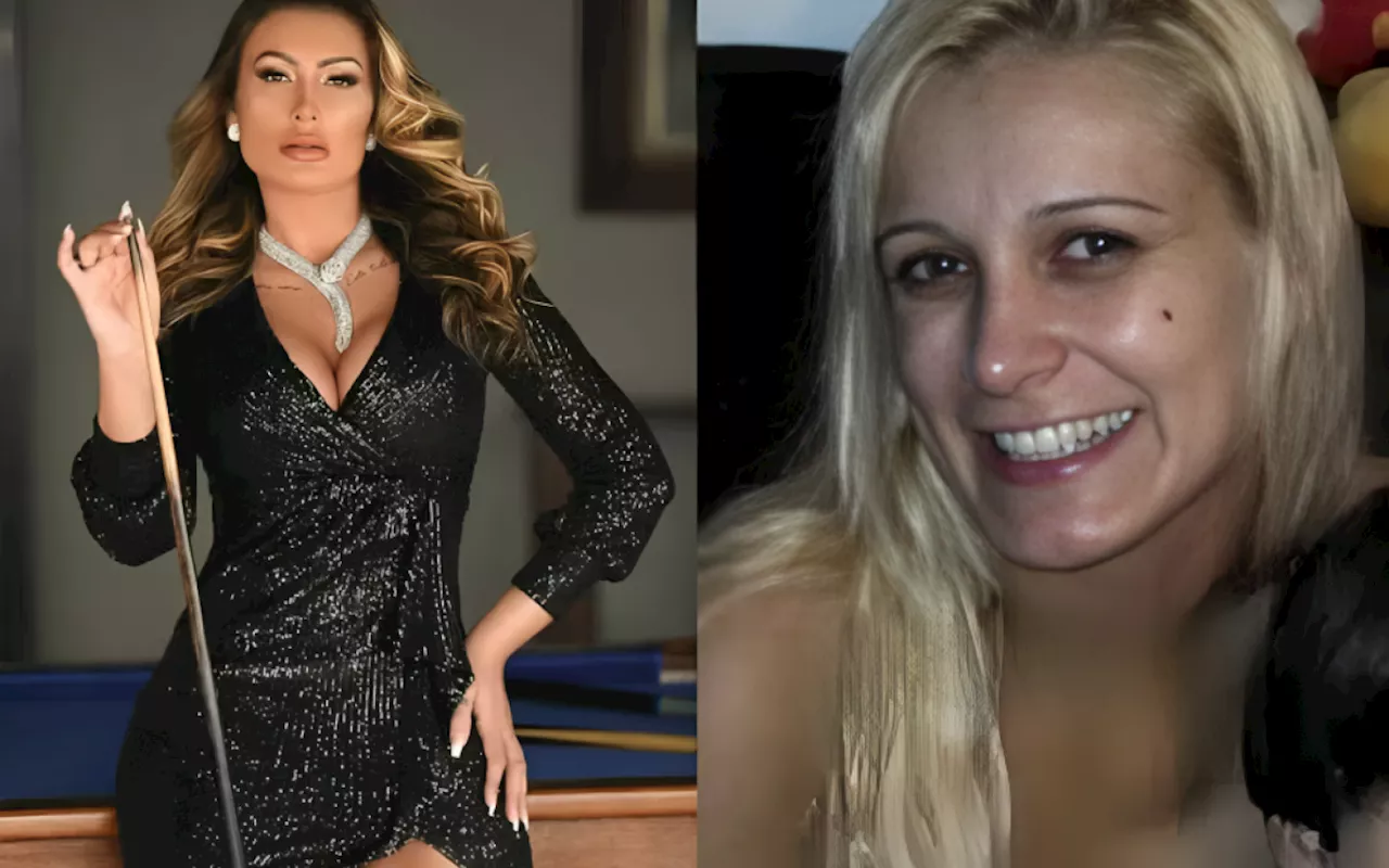 Andressa Urach choca web com antes e depois de procedimentos estéticos