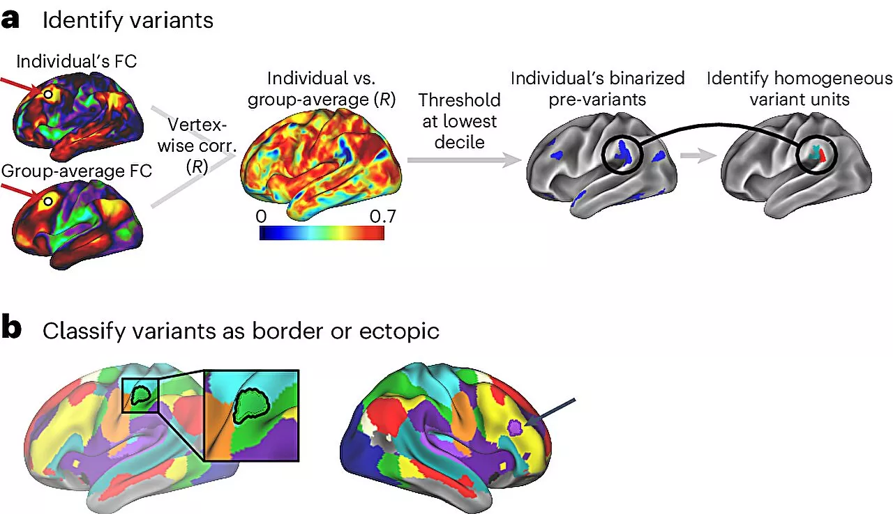 Neuroscientists discover two specific brain differences linked to how brains respond during tasks