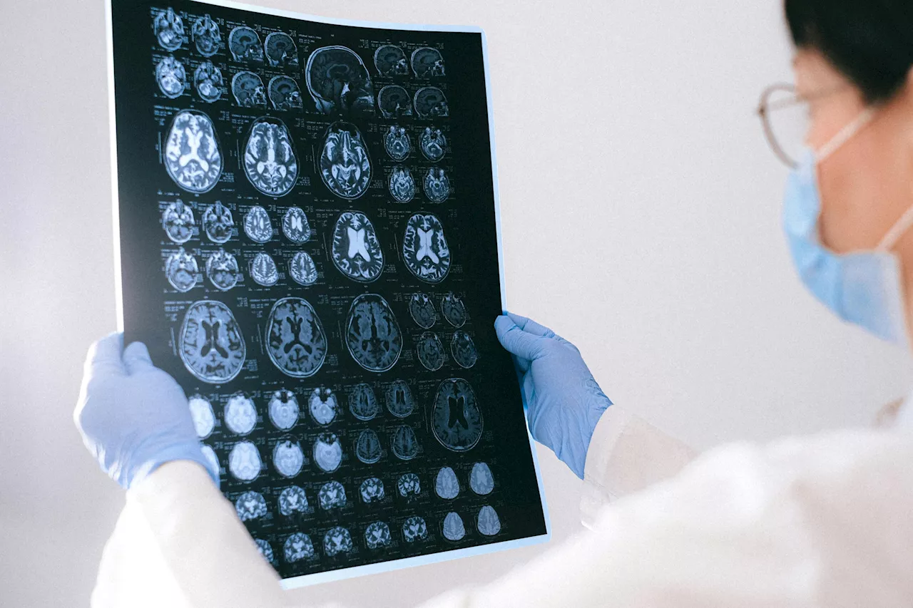 Neuroscientists find integrity of white brain matter in superagers does not deteriorate, explains sharp memory
