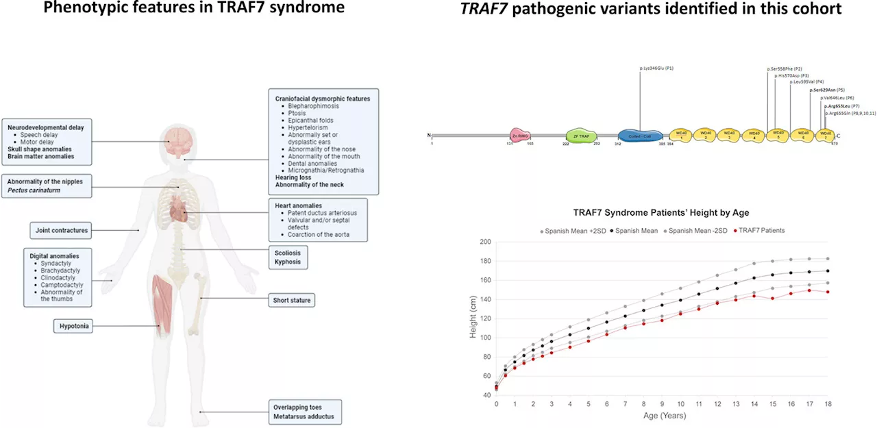 New findings better elucidate TRAF7 syndrome, a neurological and developmental disease