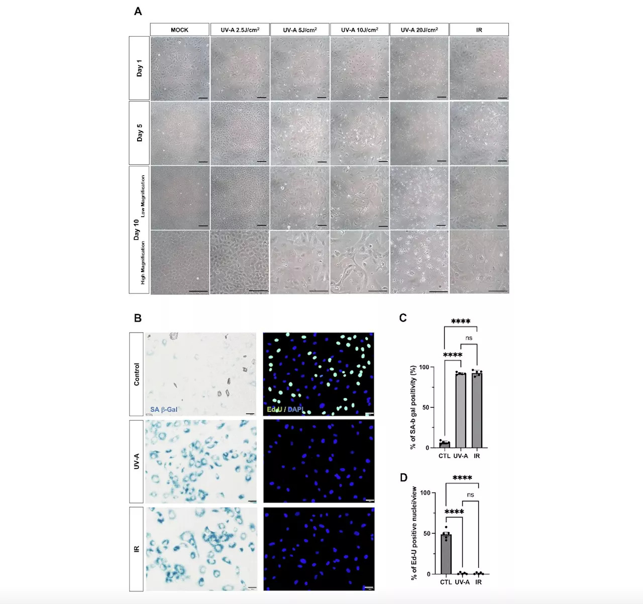 Research reports on senescent characteristics of human corneal endothelial cells upon UV-A exposure