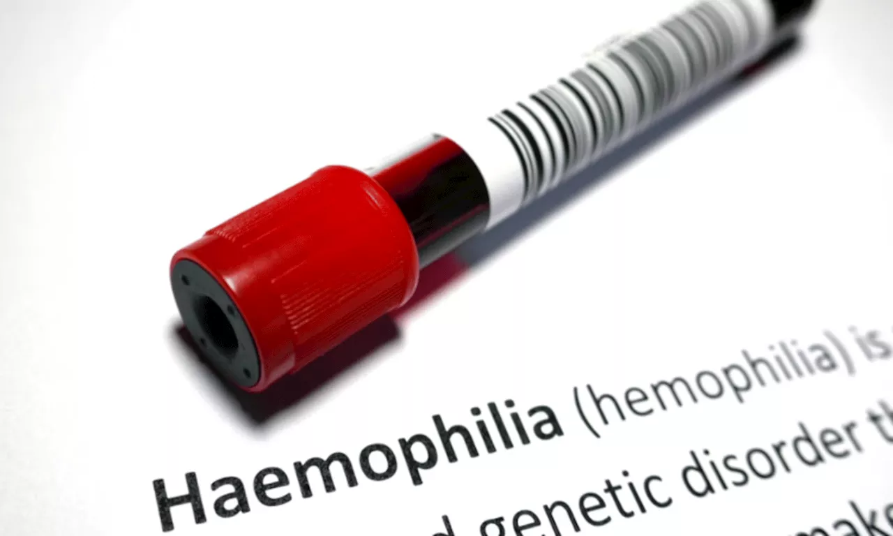 Davao CHO seeks budget boost for Hemophilia treatment