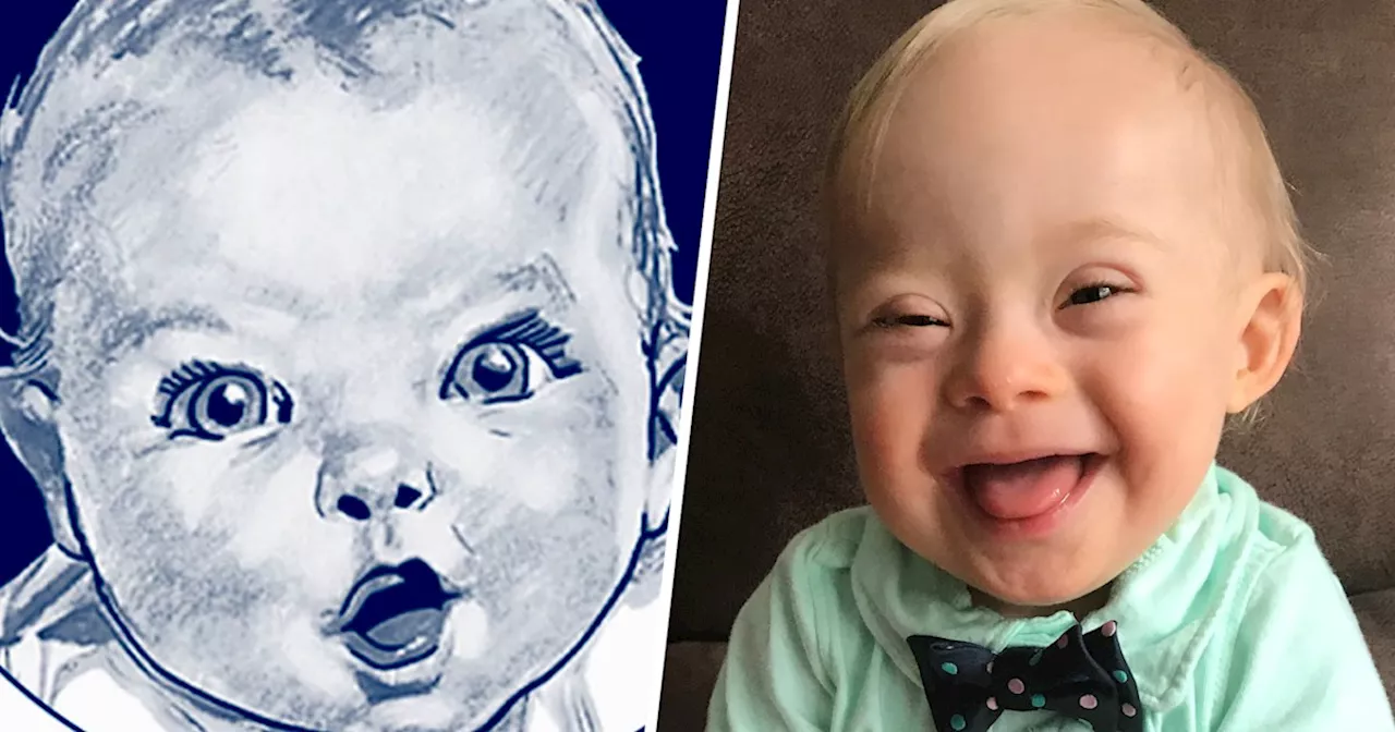 2018 Gerber baby is first Gerber baby with Down syndrome