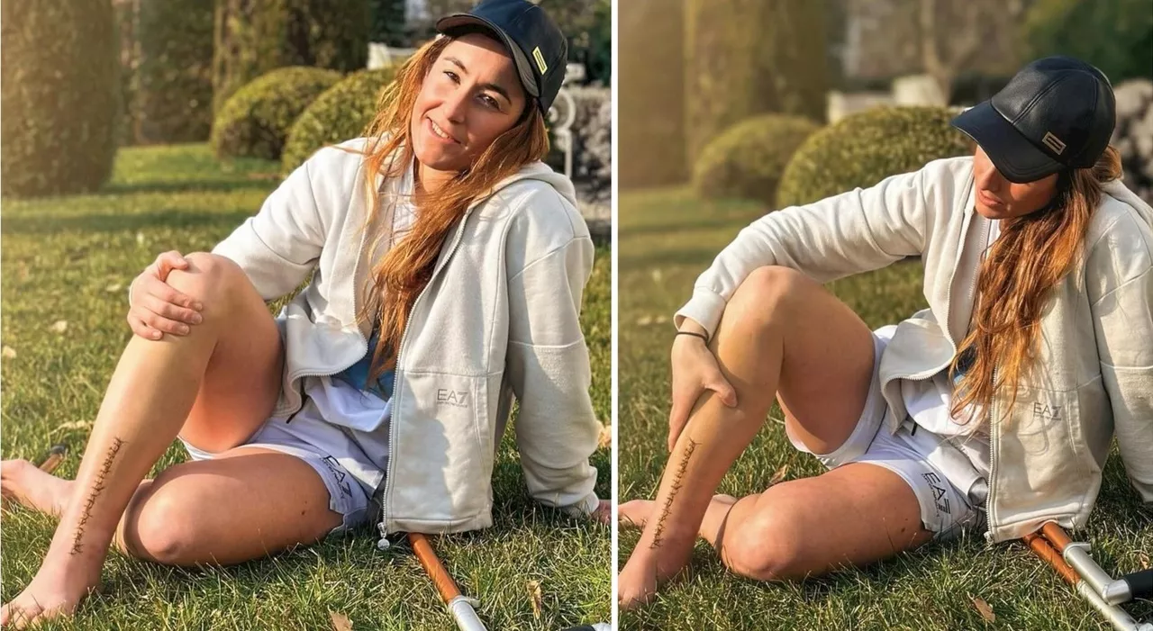 ⁠⁠Sofia Goggia, la foto dopo l’operazione: «Quello che fa più male è lo strappo che ho dentro»