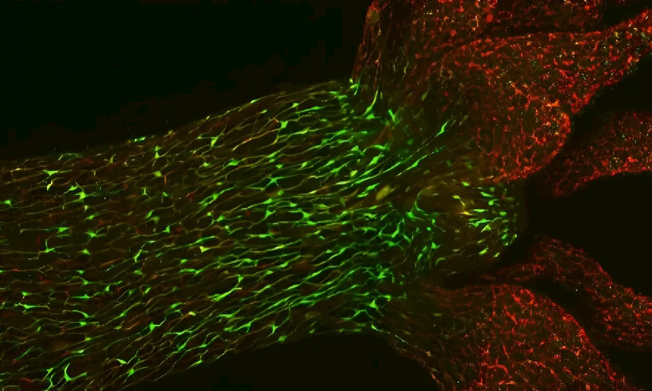 Scientists observe neuronal stimulus transmission by coloring nerve cells with novel antibody